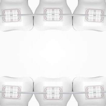 White Clear Teeth With Ceramic Braces. EPS10 Vector