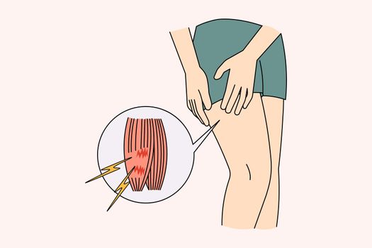 Closeup of sportsman stretch leg muscle suffer form pain. Unwell person having injury or cramp from sports activity. Athlete trauma and first aid concept. Vector illustration.