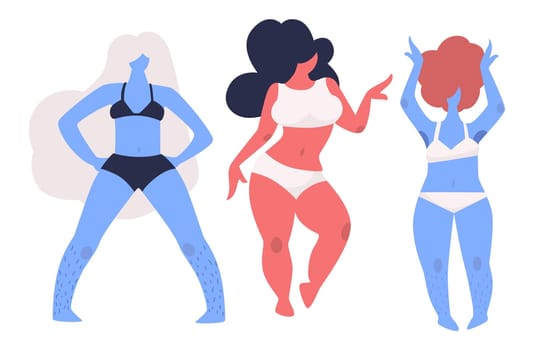 Body positive attitude for women, isolated ladies loving their shape and flaws. Female characters do not shaving legs, plus size girls and teenagers models in underwear. Vector in flat style