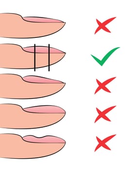 Illustration with hardware manicure technology. Correct formation of the nail shape and errors. Educational material on vector