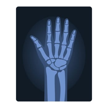 Xray shot of human hand. Medical injury test, body radiography cartoon vector illustration