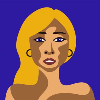 Young woman with the skin disease vitiligo with a European appearance in a minimalist style