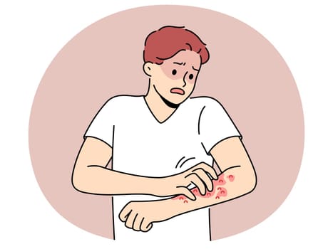 Unhealthy man scratch red pimples on arm suffer from allergy or dermatitis. Stressed unwell guy suffer from itchiness and redness. Healthcare. Vector illustration.