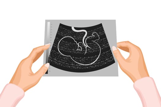 Photograph of an ultrasound of an unborn baby's embryo in the mother's hands. Illustration, vector