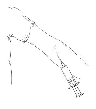 sketch of the blood collection, hand and injection, isolate