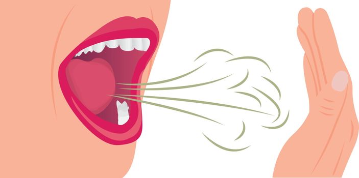 Bad smell air from a mouth. Oral hygiene concept vector illustration on a white background.