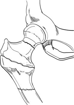 Illustration of a bone on a white background