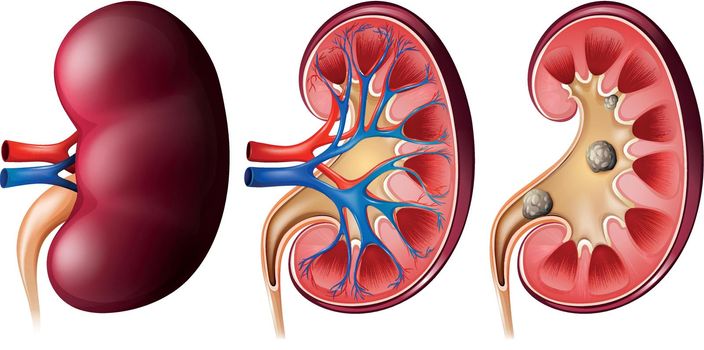 A set of 3 kidneys