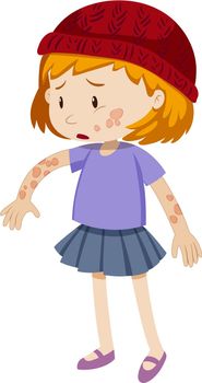Little girl with ringworm on her body illustration