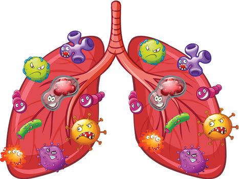 A Vector of Lung Bacteria illustration
