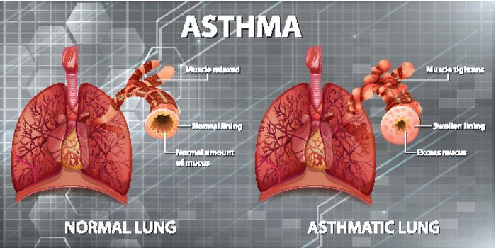 Human anatomy Asthma diagram illustration
