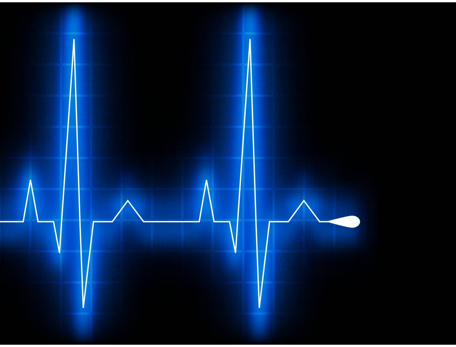 Blue heart beat. Ekg graph. EPS 8 by Petrov_Vladimir