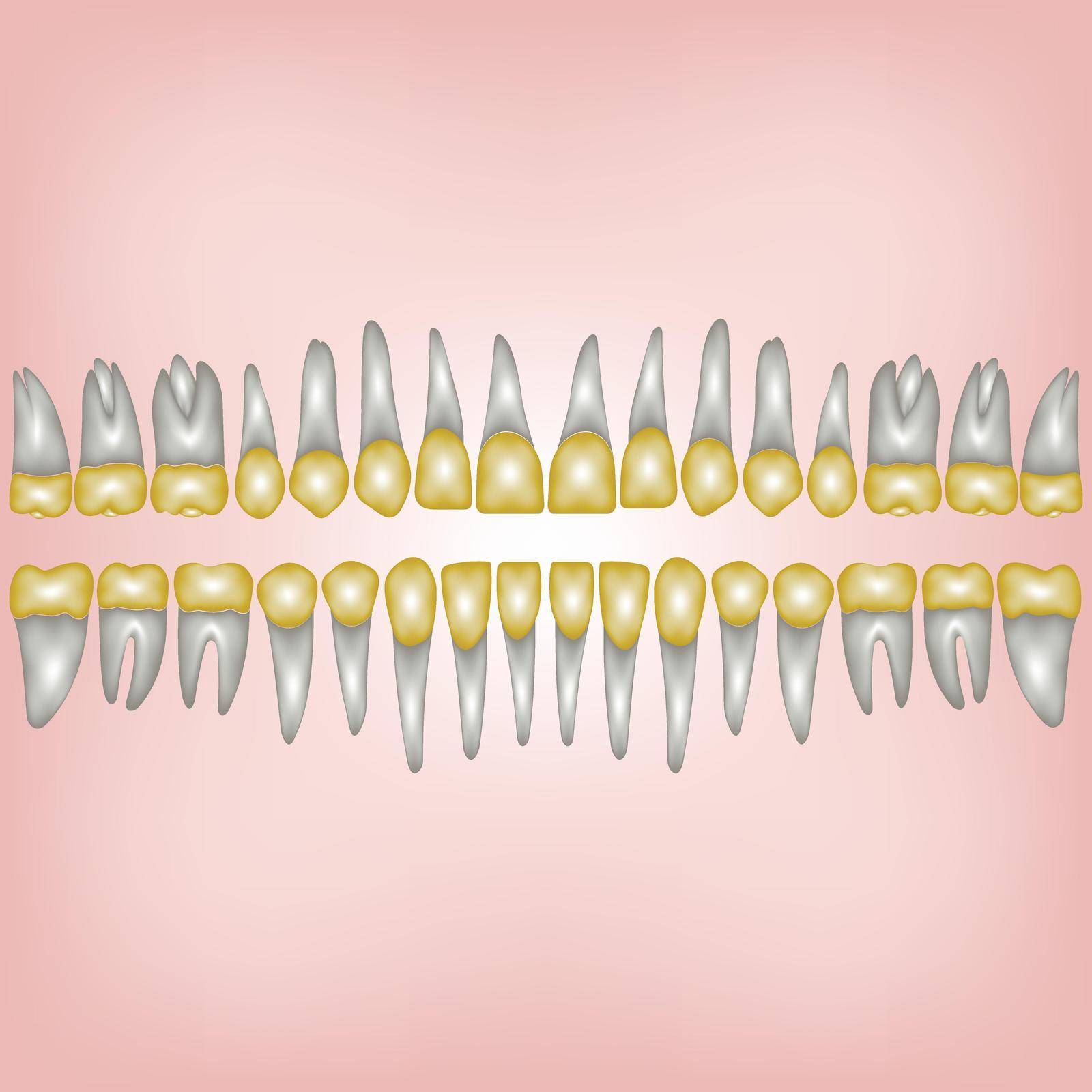 3D a number of gold dental crowns with the roots for a dental clinic or lab, vector on white