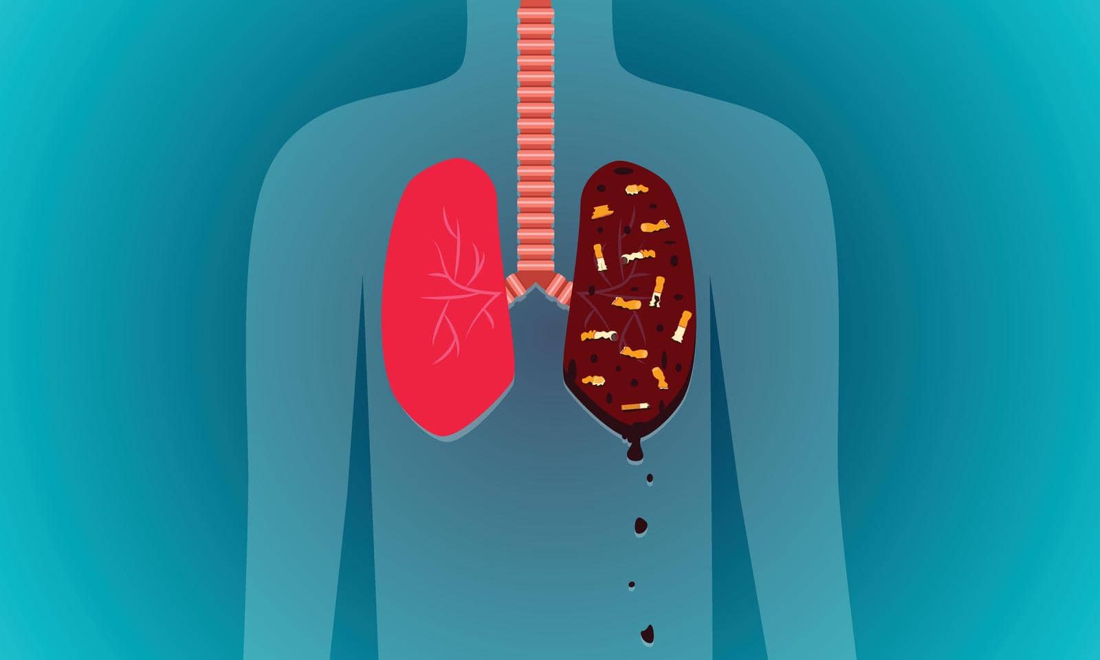 damage lung with cigarette smoke. dangerous to health kid other people. vector illustration eps10