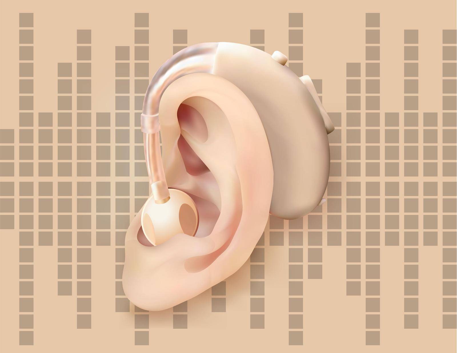 Digital hearing aid behind the ear, on background of sound wave diagram. Treatment and prosthetics of hearing loss in otolaryngology. Realistic vector illustration. Medicine and health.