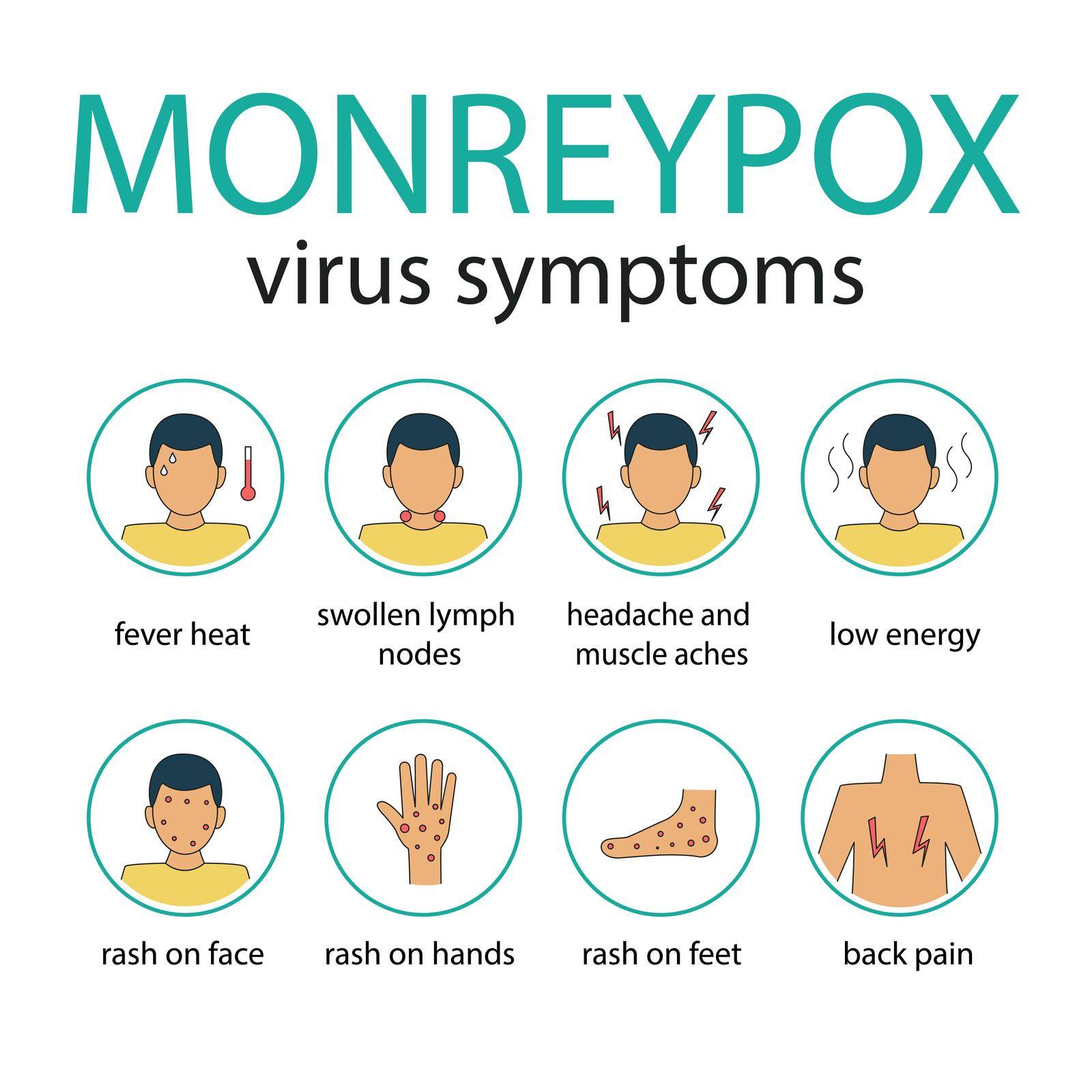 Monkeypox virus symptoms. Monkeypox virus detailed infographic. Information banner with signs of disease. Icons with man and inscriptions. Vector illustration