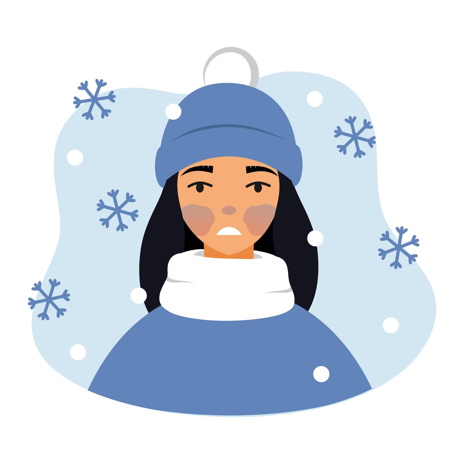 Woman got frostbite face. Beauty and health. Cold allergy. Vector character in cartoon style. by polinka_art