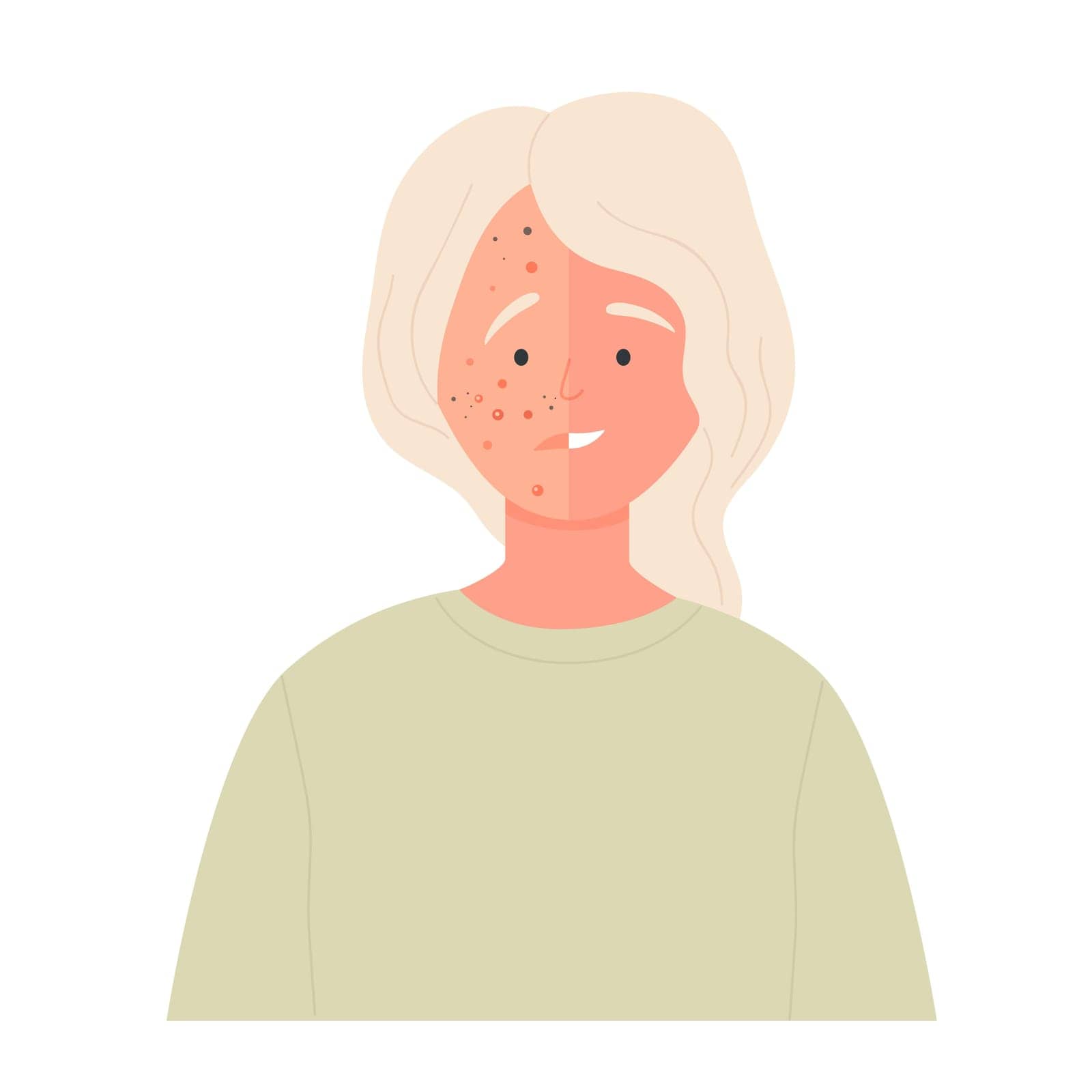 Acne face before and after treatment. Sad girl with dermis problems and clean treated skin flat vector illustration