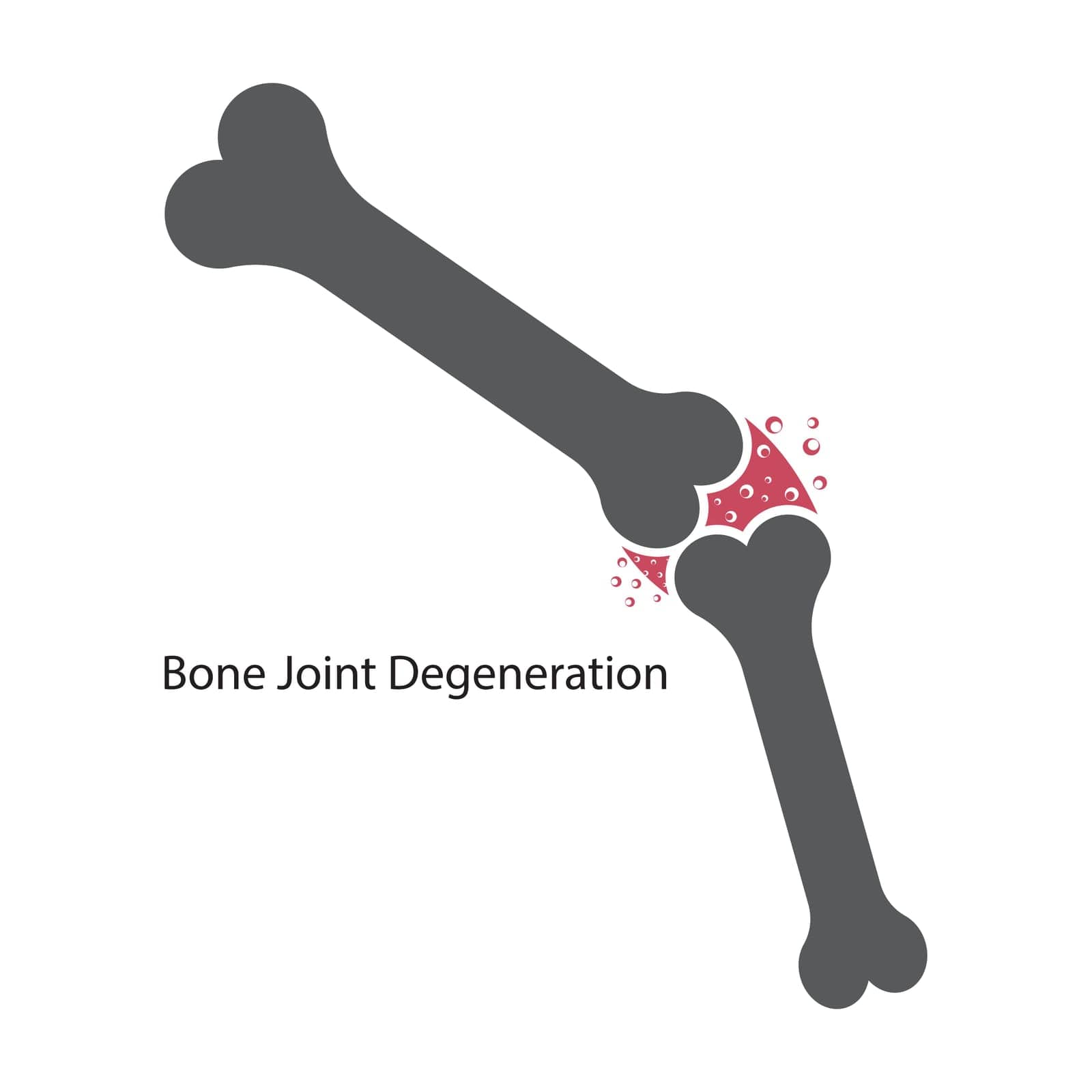 Bone joint degeneration icon,vector symbol design