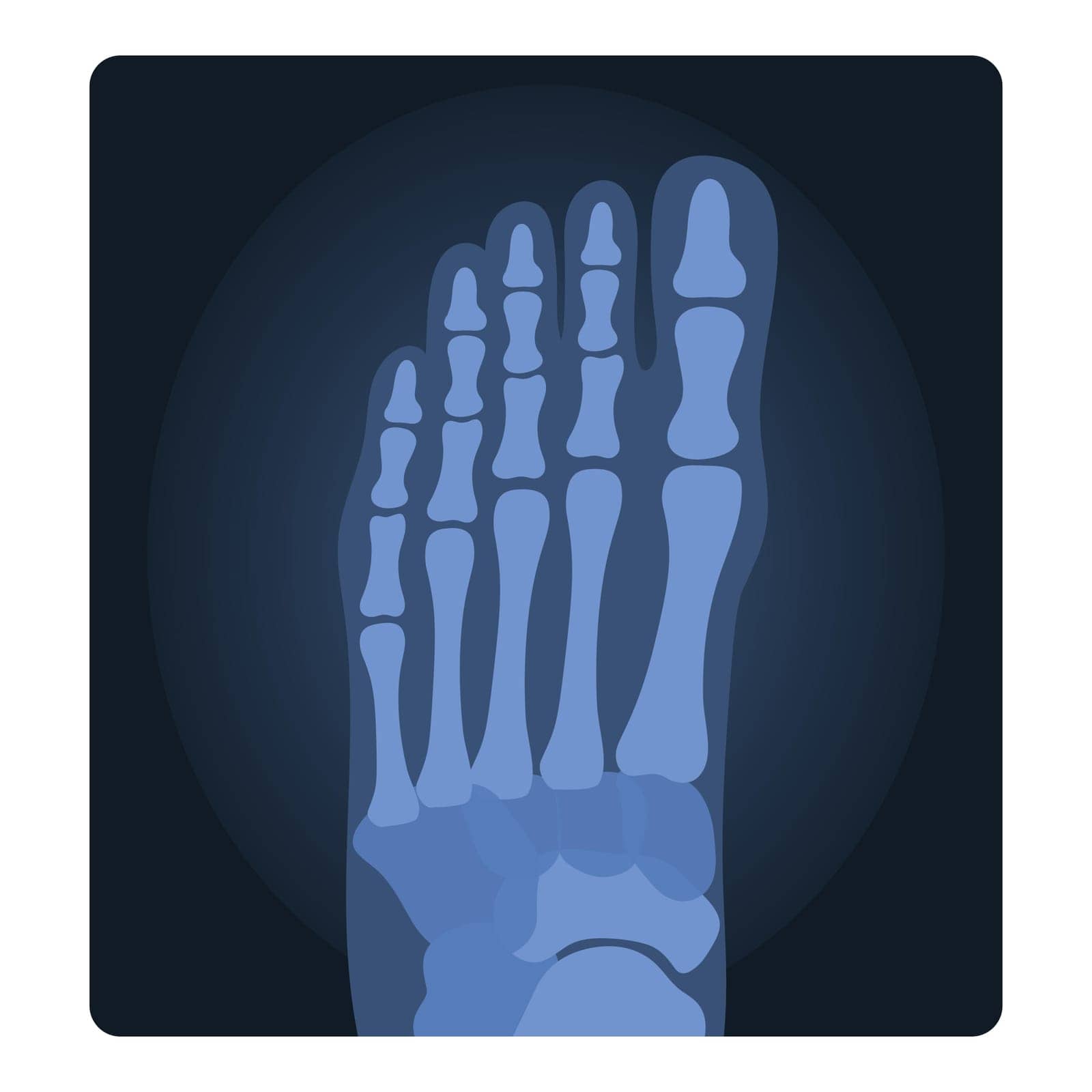 Xray shot of human foot. Medical skeleton test, body radiography cartoon vector illustration