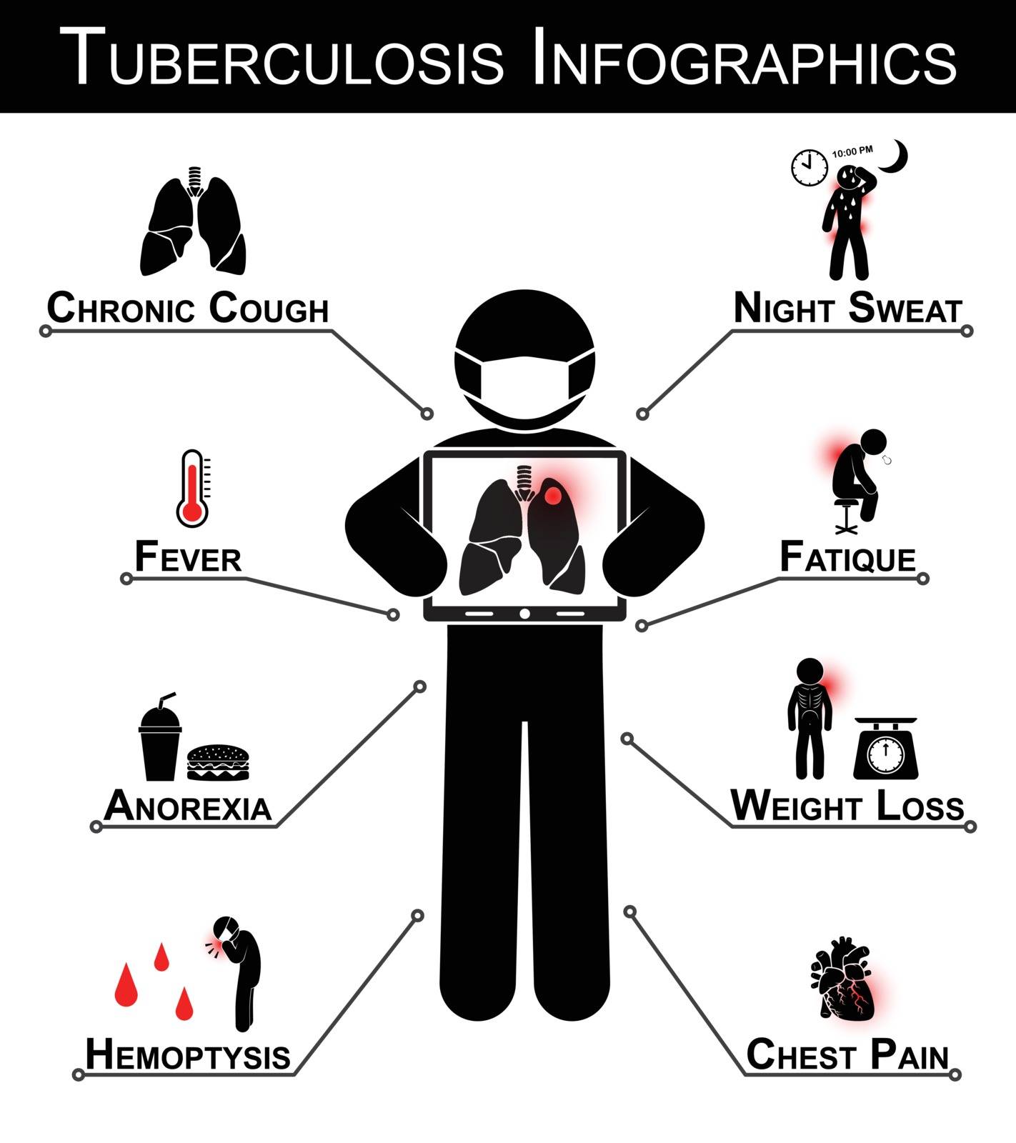 Tuberculosis ( TB ) Infographics ( Tuberculosis symptom : Chronic cough , Night sweat , Fever , Fatique , Anorexia , Weight loss , Hemoptysis , Chest pain ) by stockdevil
