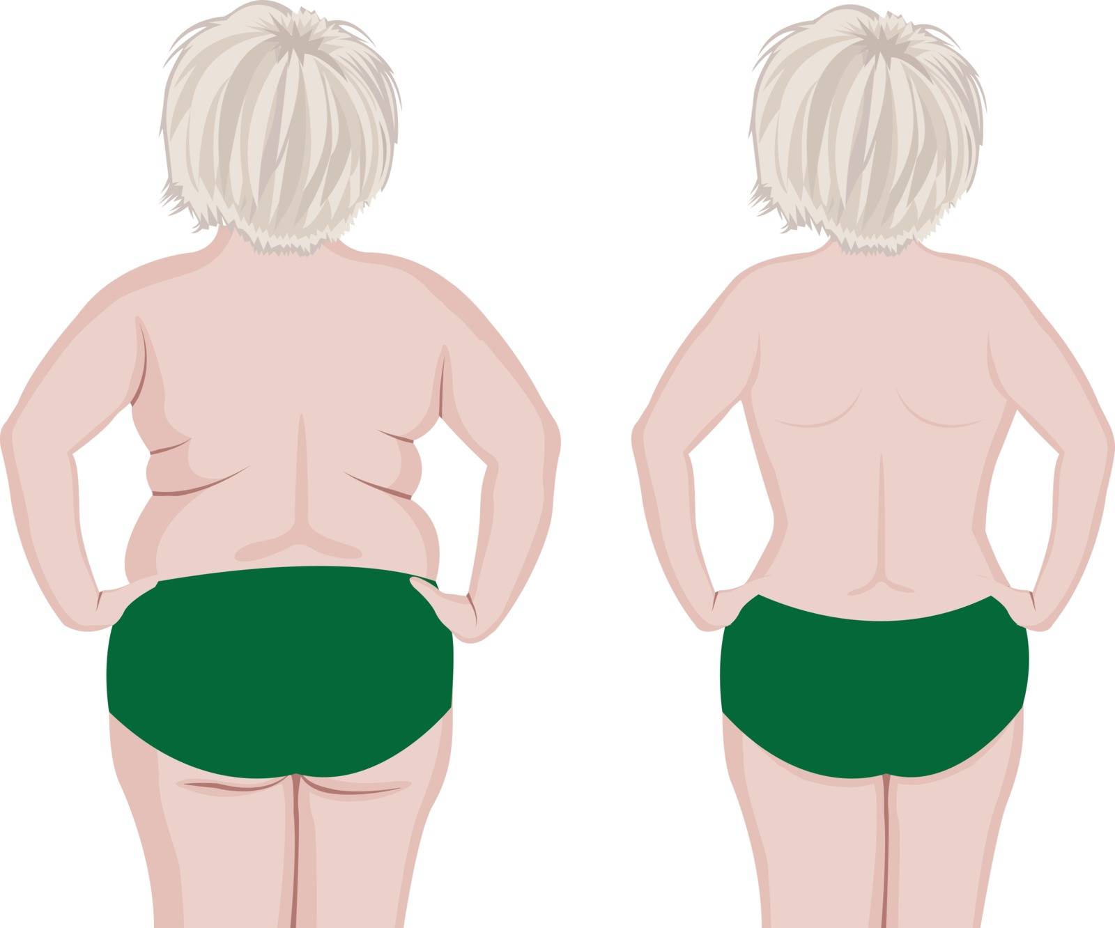Fat and slim girl back. before and after reshaping vector illustration