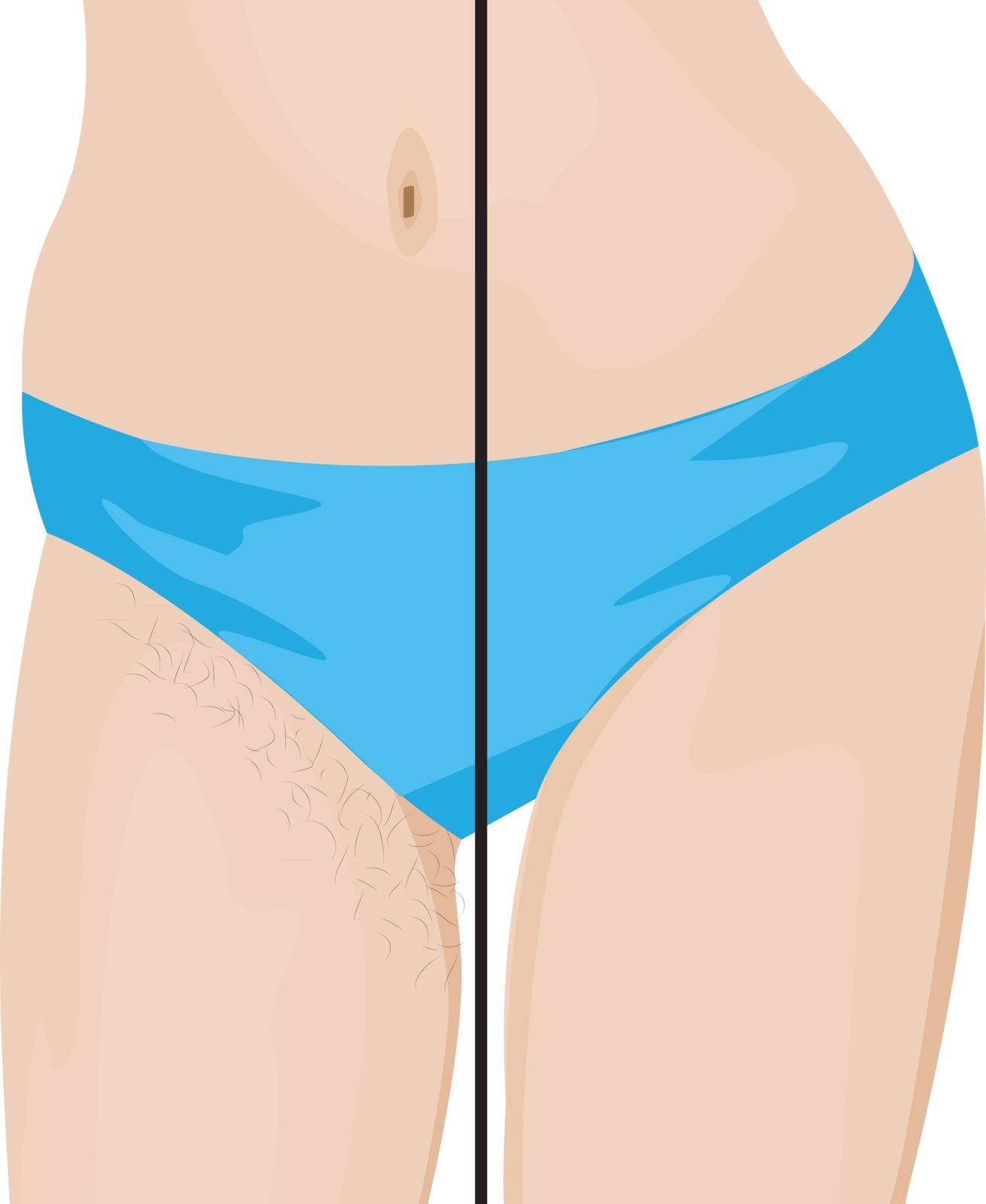 Hair removal results before and after depilation procedure vector illustration