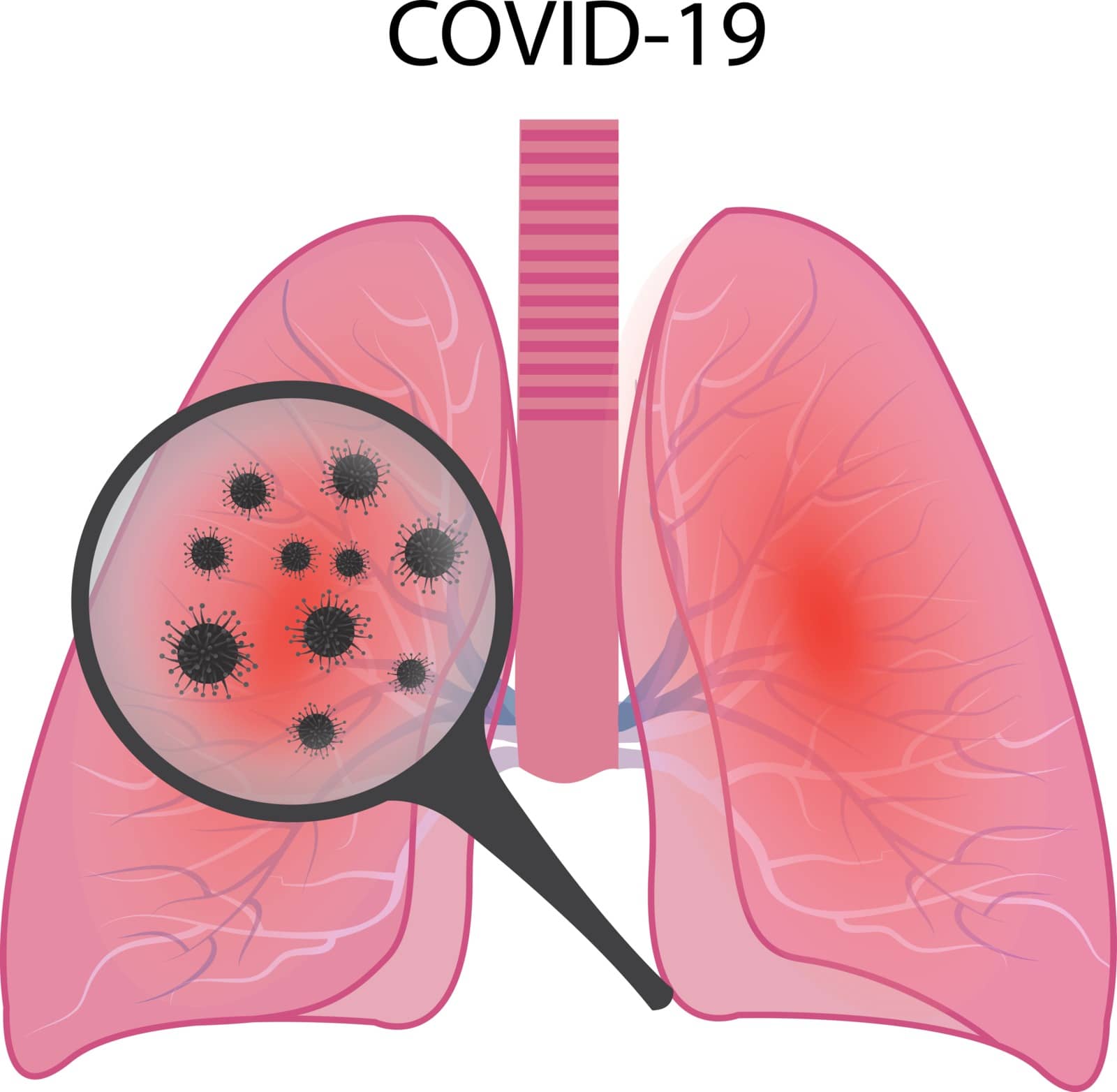 Lungs affected with coronavirus infection COVID19 vector illustration isolated on a white background