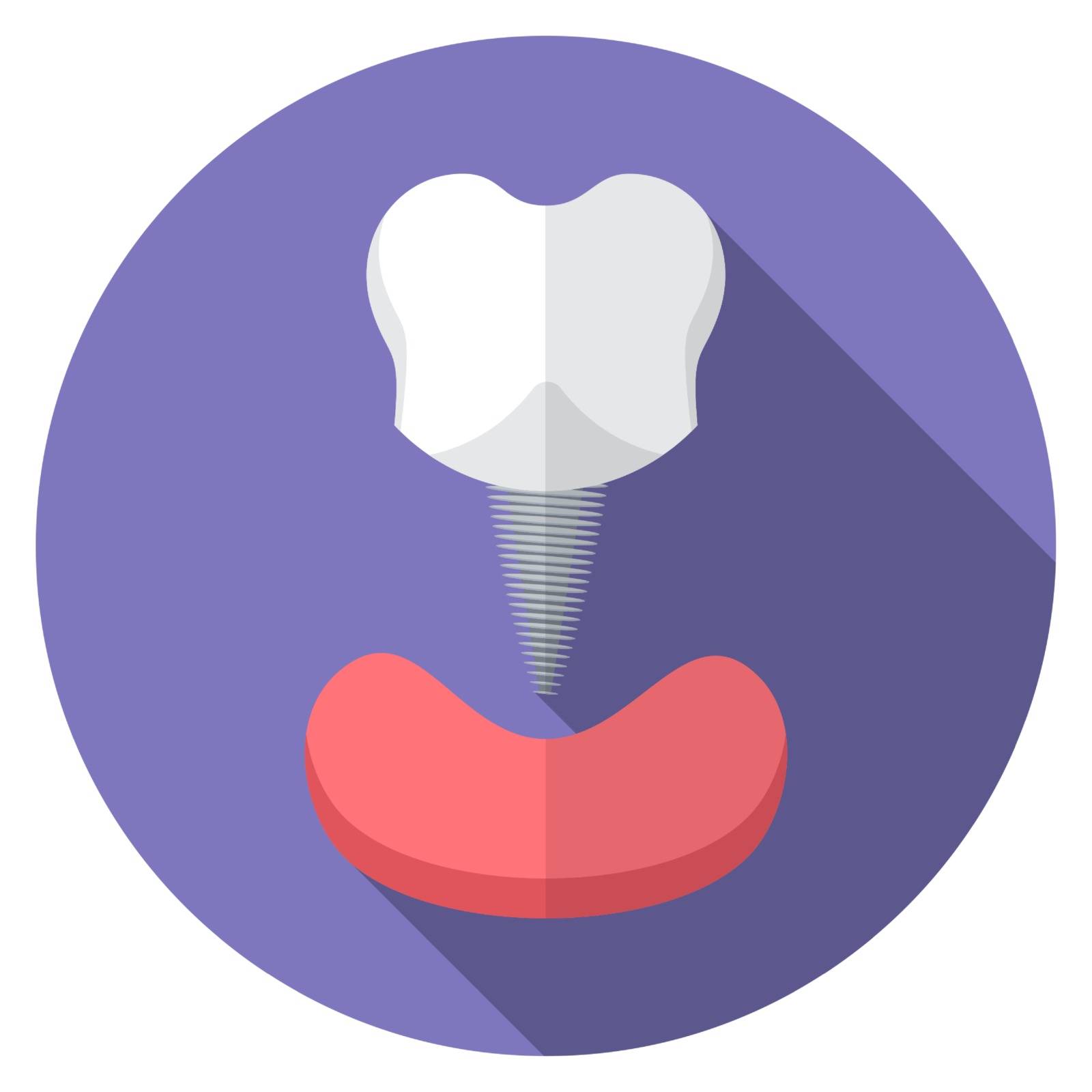 Flat design modern vector illustration of tooth implant icon with long shadow, isolated by Lemon_workshop