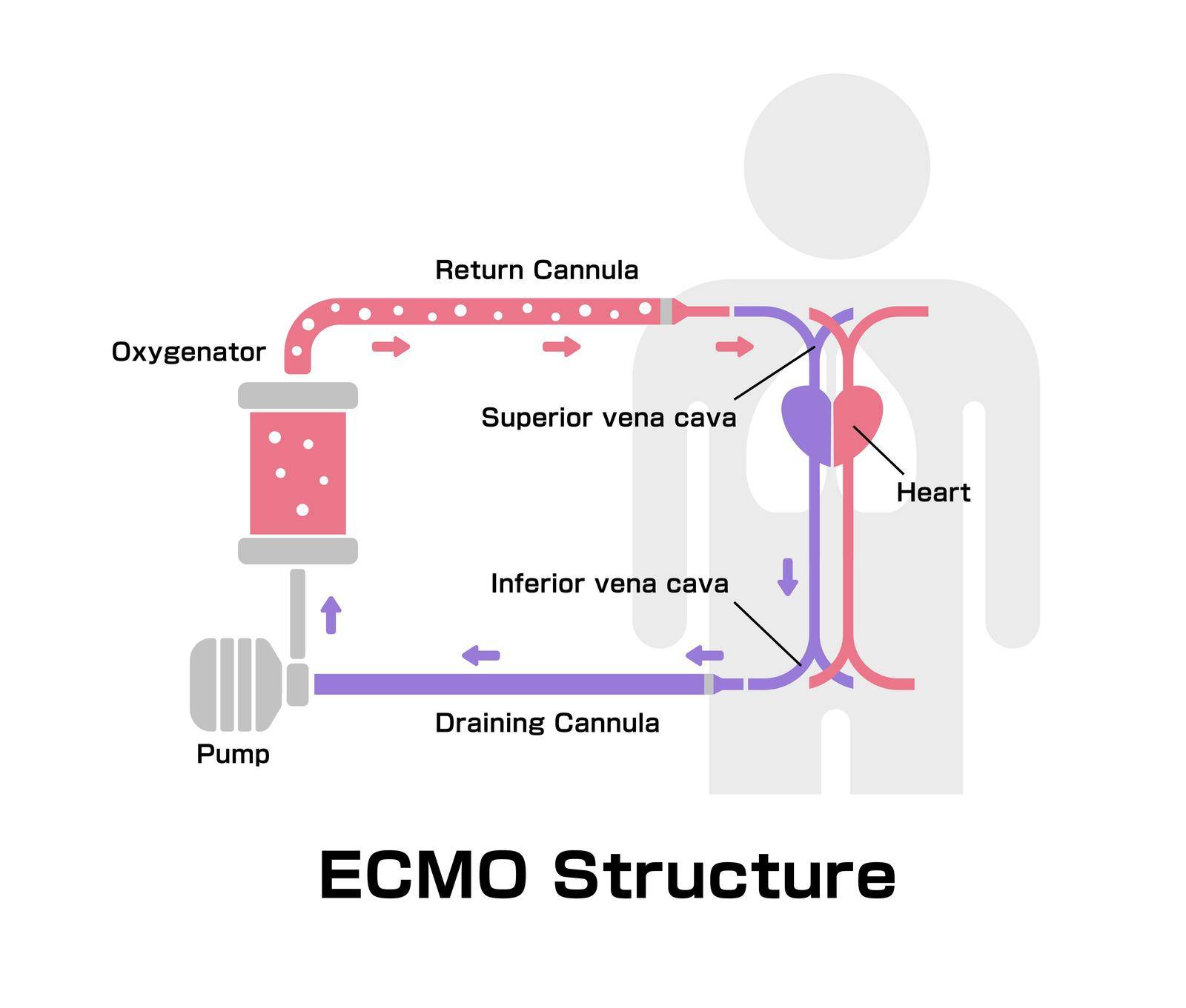 ECMO ( Extracorporeal membrane oxygenation ) structure vector illustration