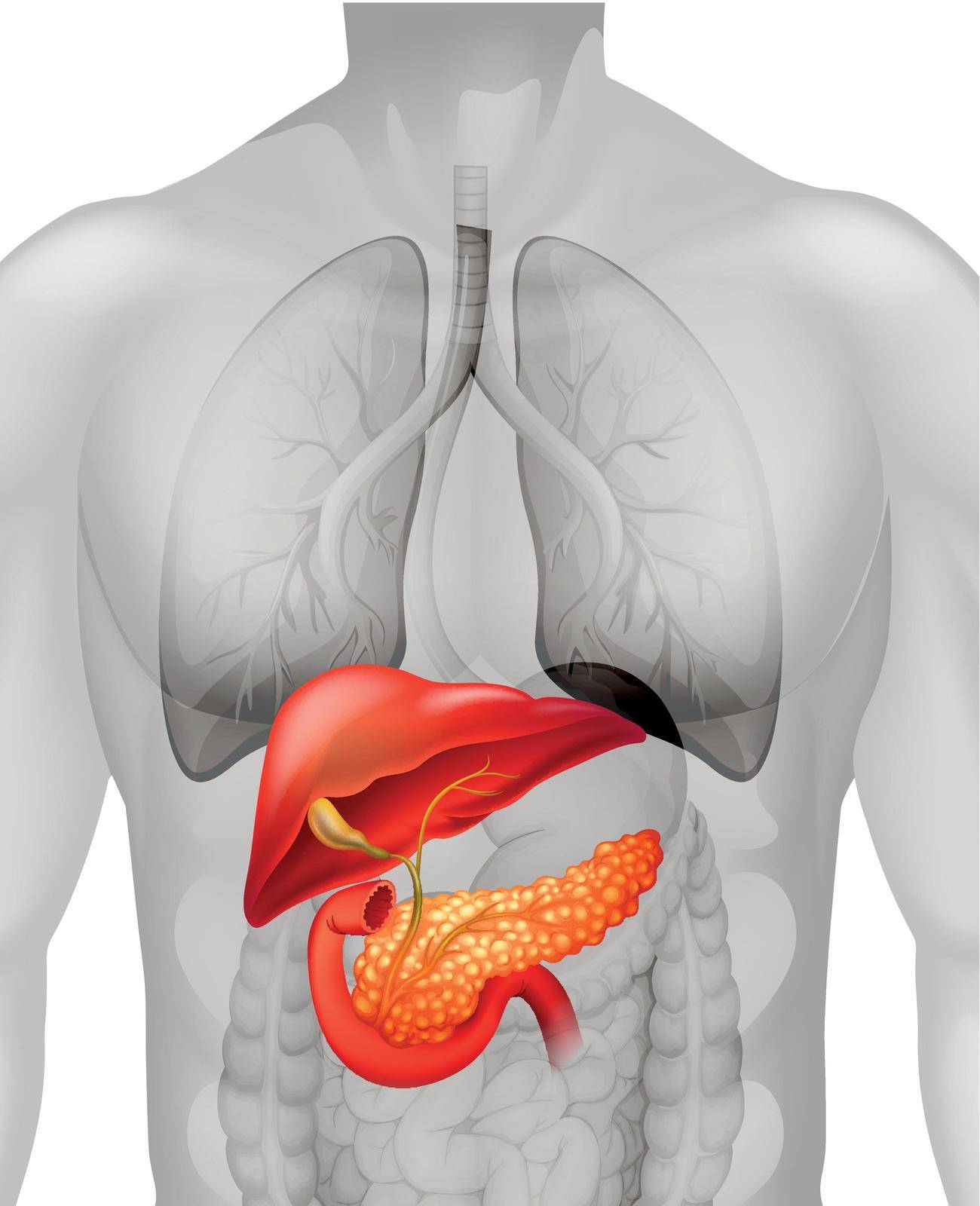 Pancreas cancer in human illustration
