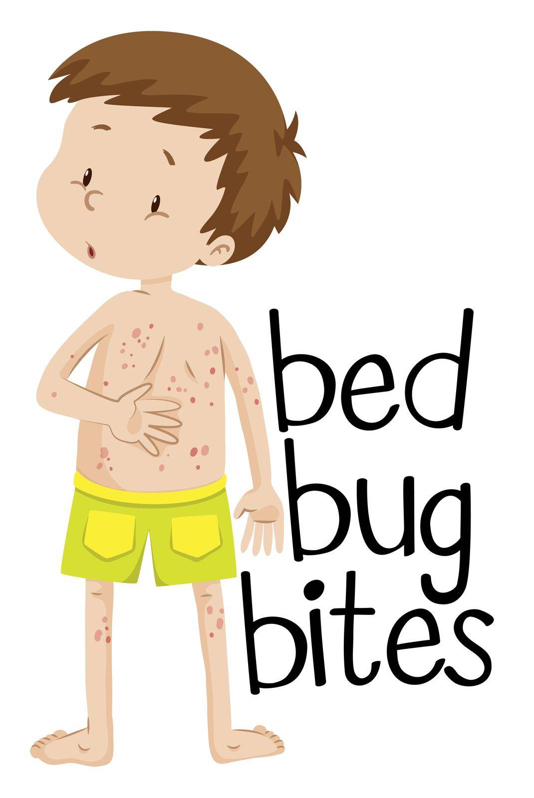 Boy having bed bug bites illustration