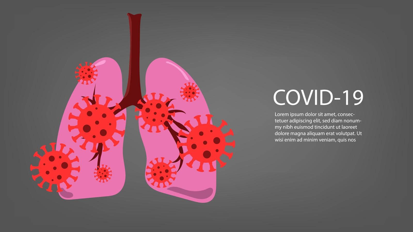 Virus cells in lung. Infected lungs. Coronavirus, COVID-19. 2019-nCoV. lung disease, pneumonia, asthma, cancer, tuberculosis.